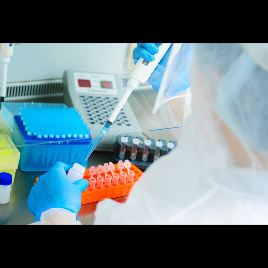 Hieff UNICON® Universal Blue qPCR SYBR Master Mix-5×5mL